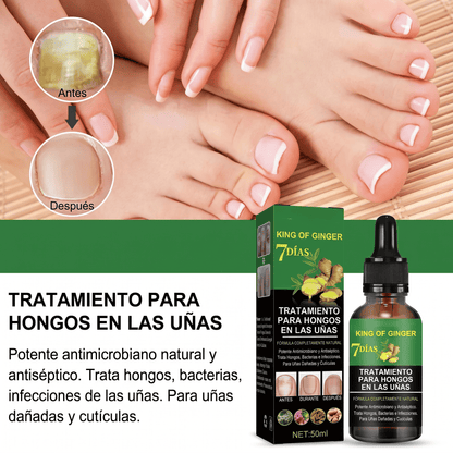 Serum de Jengibre para Uñas Sanas Fuertes.