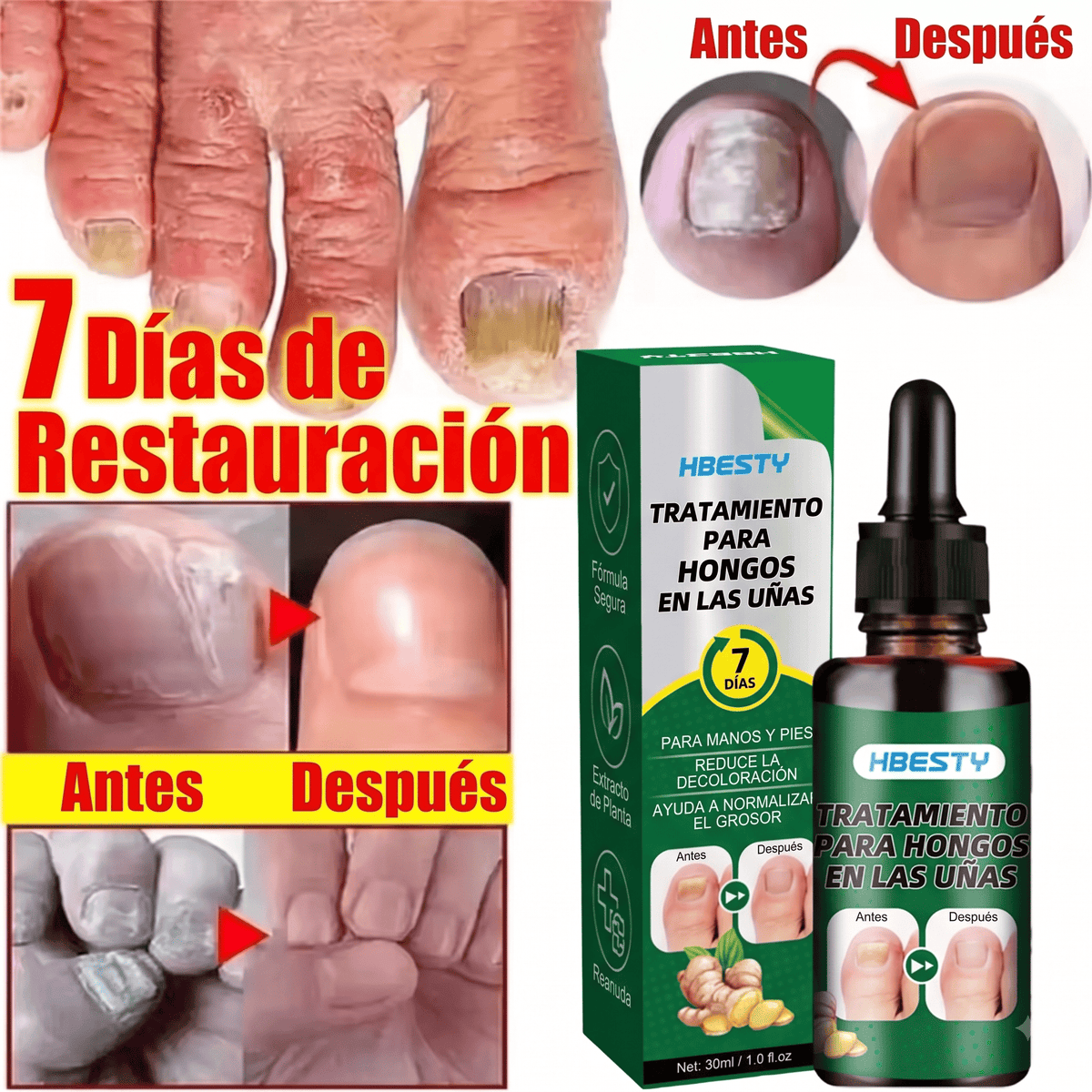Serum de Jengibre para Uñas Sanas Fuertes.