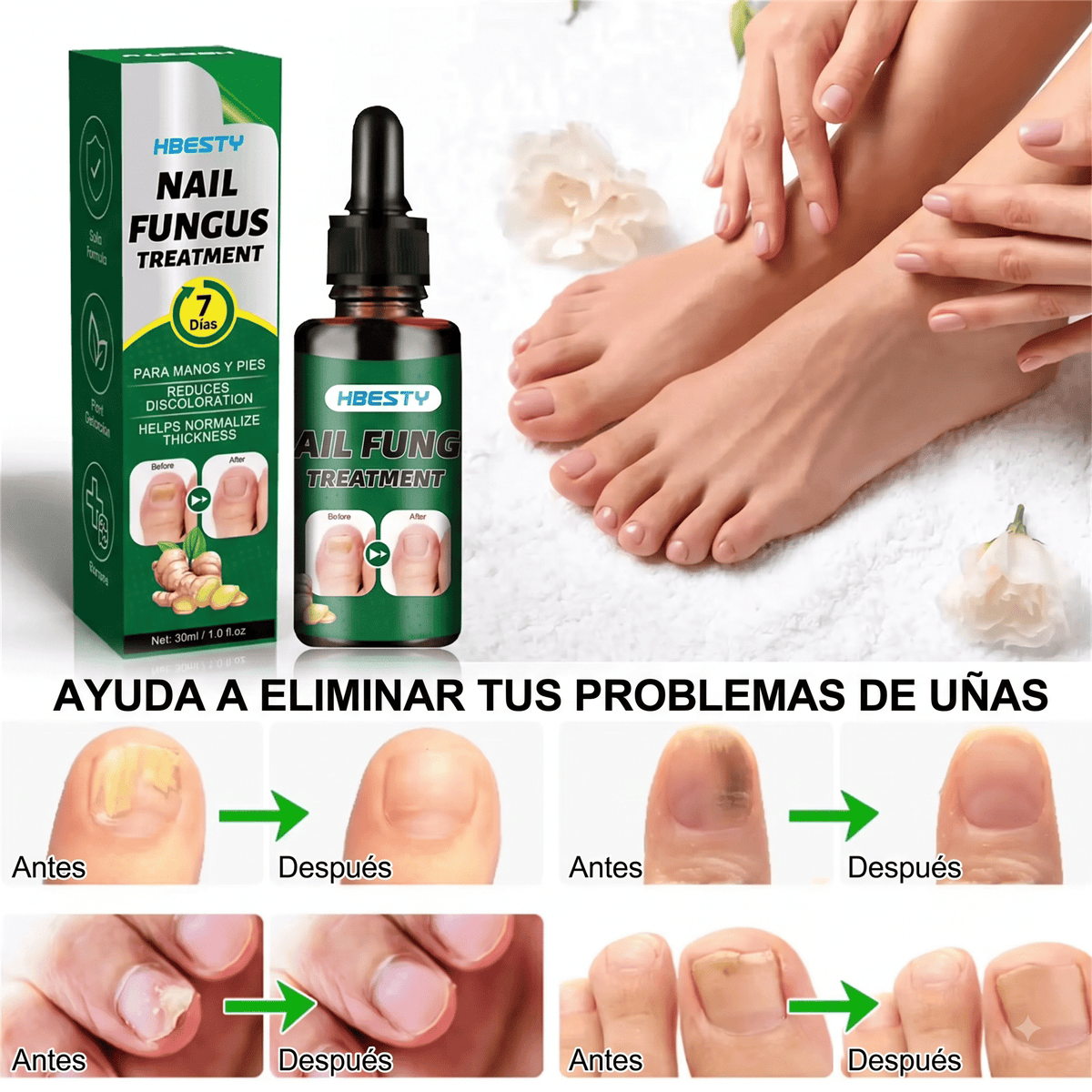 Serum de Jengibre para Uñas Sanas Fuertes.